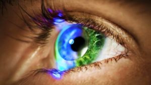 Arlington LASIK