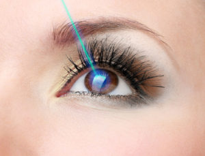 Arlington LASIK