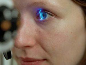 LASIK in Arlington