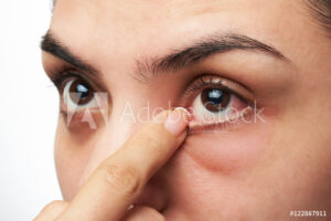 AdobeStock_122887911_Preview