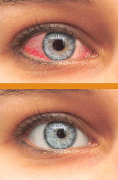 eye-compare